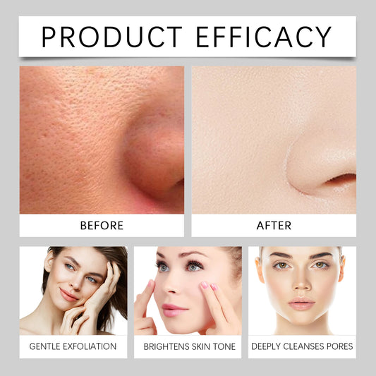 Rice Exfoliating Essence - Brightening Serum with Hyaluronic Acid